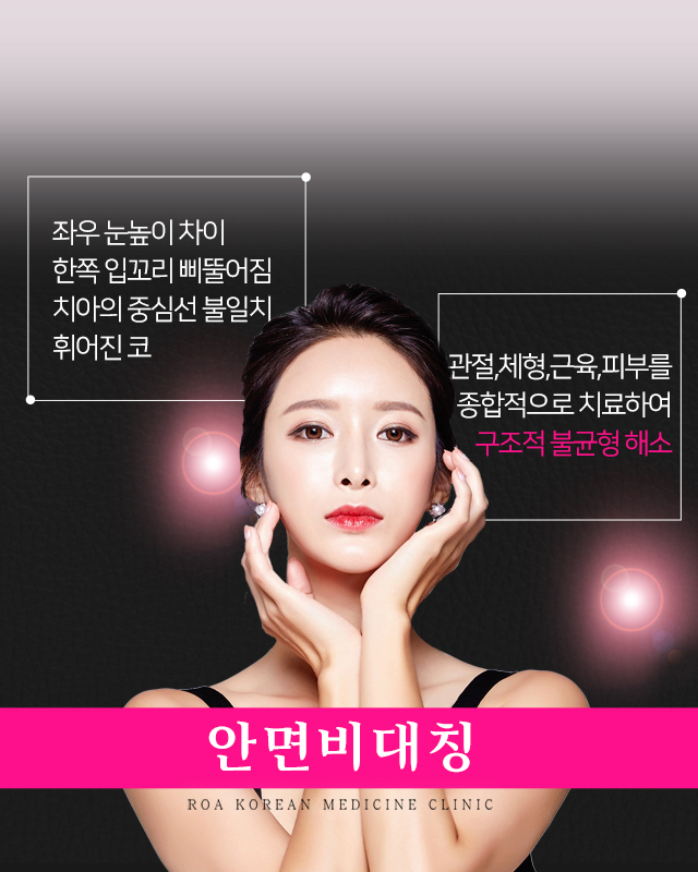 안면비대칭